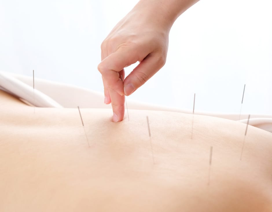 鍼灸業イメージ